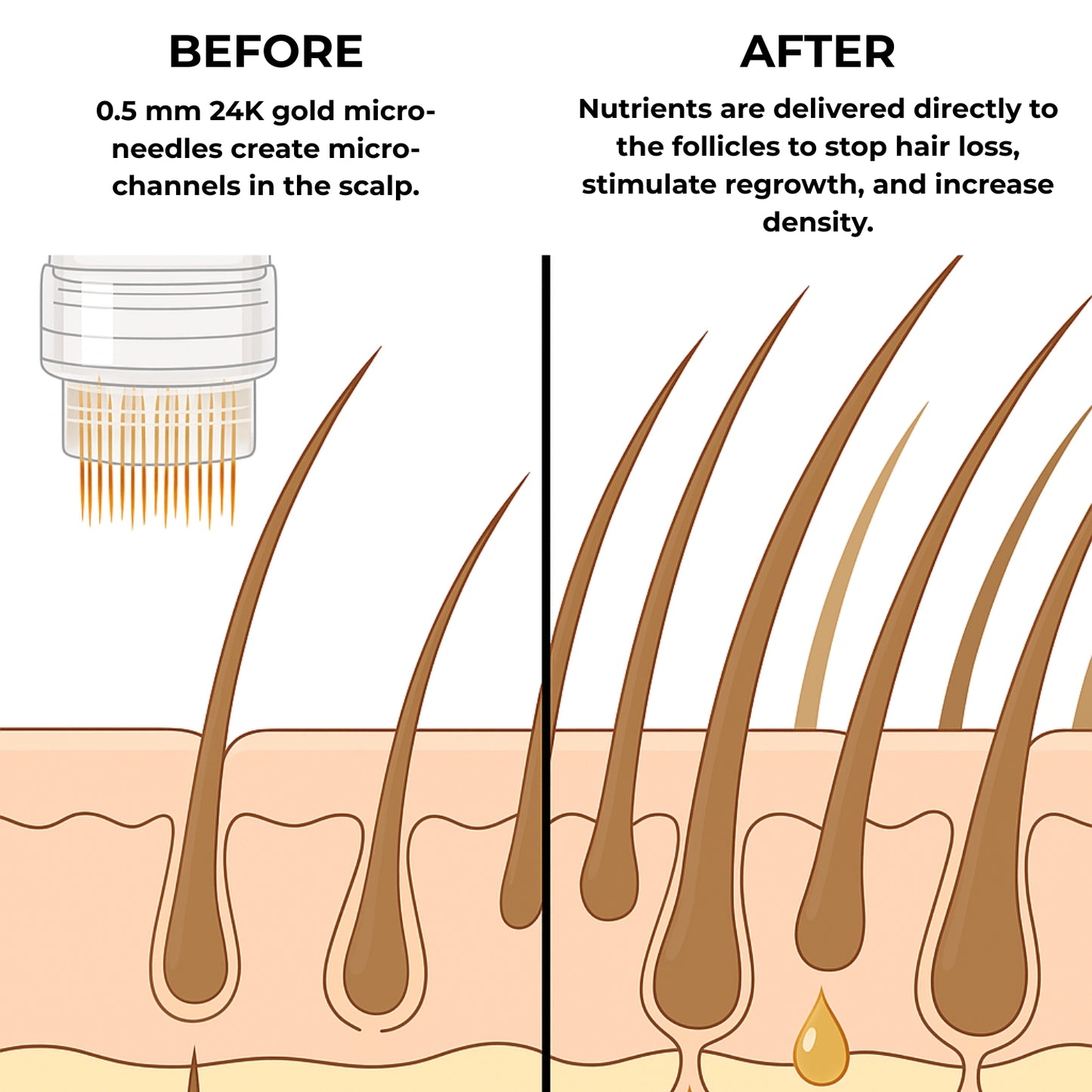 MICRO-INFUSE® Hair Technology – For Men
