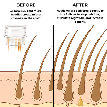 MICRO-INFUSE® Hair Technology – For Men