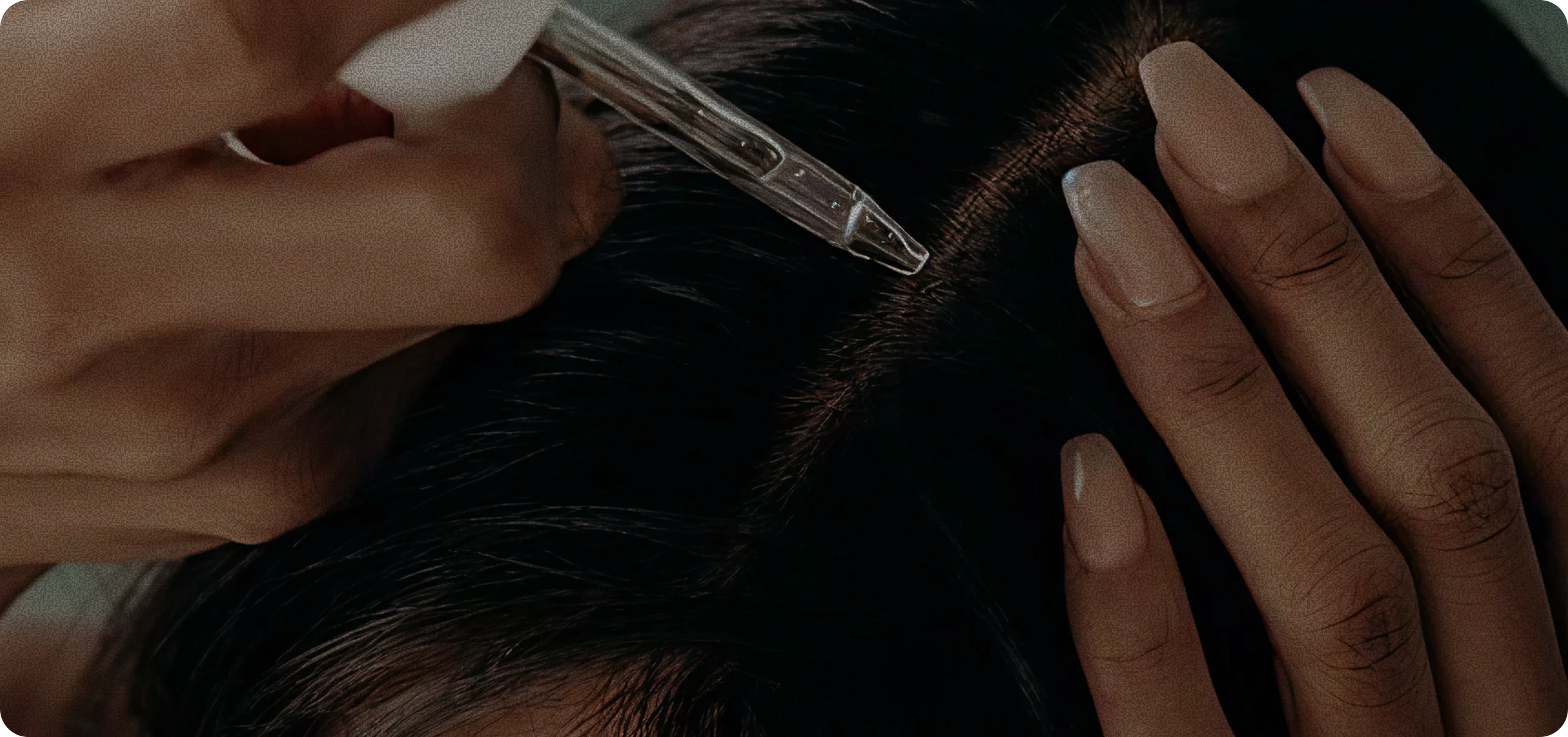 Treat the deep-rooted causes of female hair loss with a comprehensive approach.
