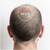 Clinically proven results. Observed by real users.