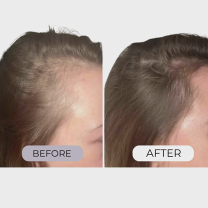Colagea® Regenerative Hair Micro-Infusion